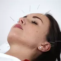 Vitalis Akupunktura