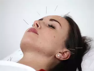 Vitalis Akupunktura