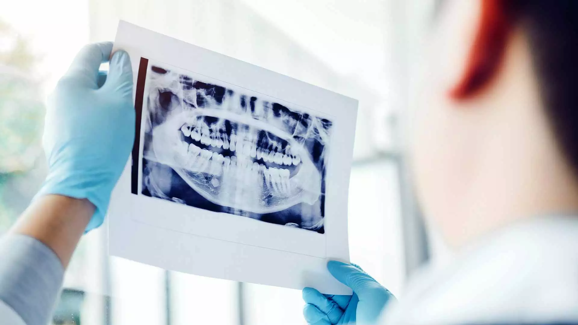 slika kategorije Dental X-Ray