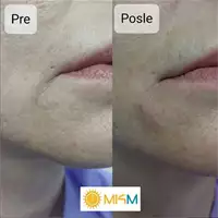 Ordinacija MKM - Aesthetic and Reconstructive Medical Procedures