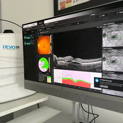 OCT najnovije generacije