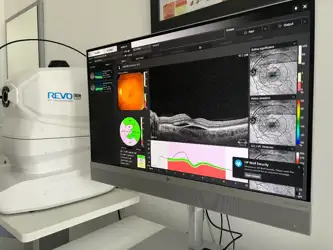 OCT najnovije generacije