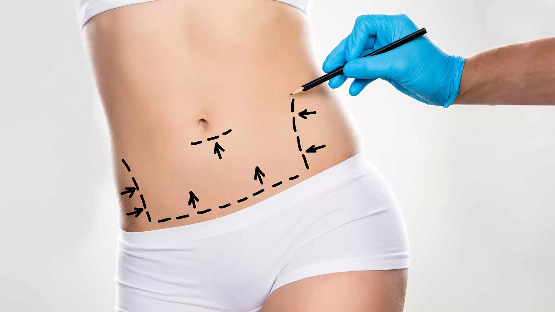 slika kategorije Aesthetic Surgery Clinics