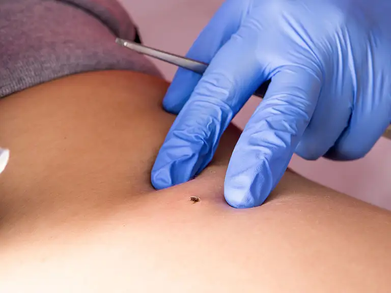 slika kategorije Dermatološke ordinacije